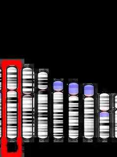 RET proto-oncogene