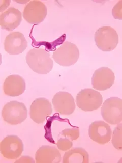 African trypanosomiasis