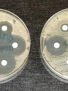 Antimicrobial resistance