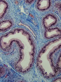 Connective tissue
