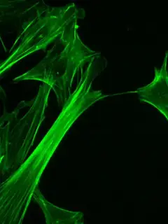 Actin filament