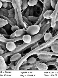 Candida albicans