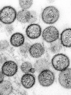 Orthohantavirus