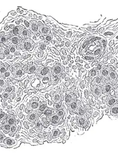 Corpuscule carotidien