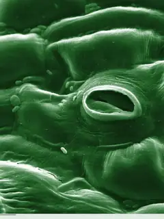 Stoma