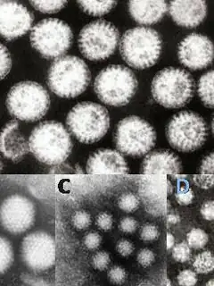 Gastroenteritis