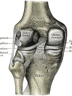 Microfracture surgery