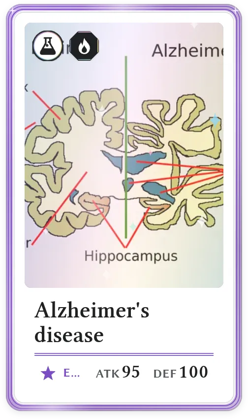 Alzheimer's disease, Epic, ATK 95, DEF 100