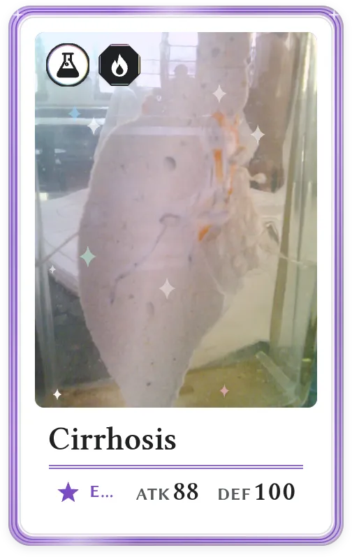 Cirrhosis, Epic, ATK 88, DEF 100