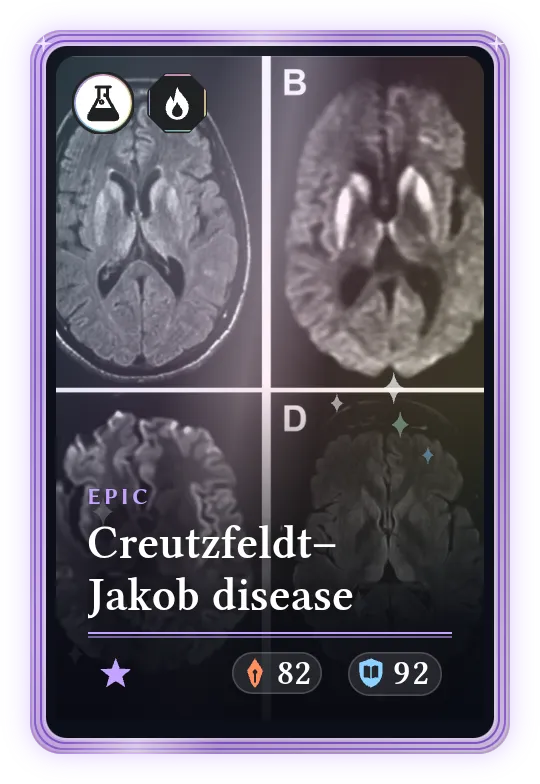 Creutzfeldt–Jakob disease, Epic, ATK 82, DEF 92