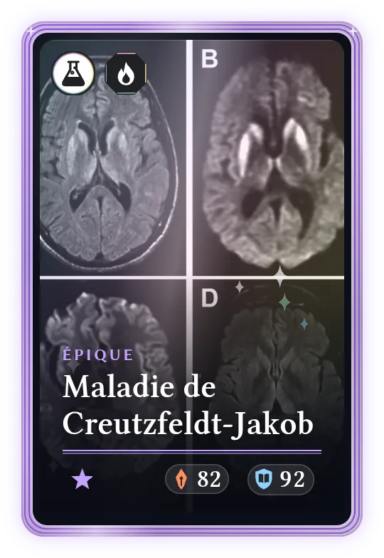 Maladie de Creutzfeldt-Jakob, Épique, ATK 82, DEF 92